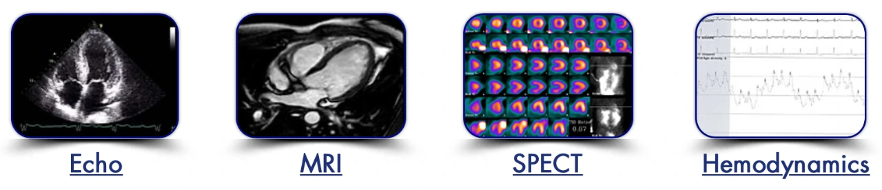 Echo, SPECT, MRI, and Hemodynamics